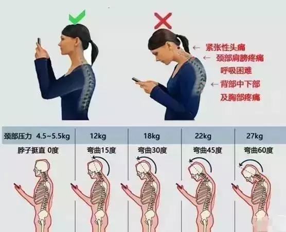 低头玩手机=谋杀颈椎+双下巴
